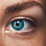 Strabismus