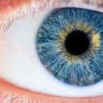 Macular Degeneration